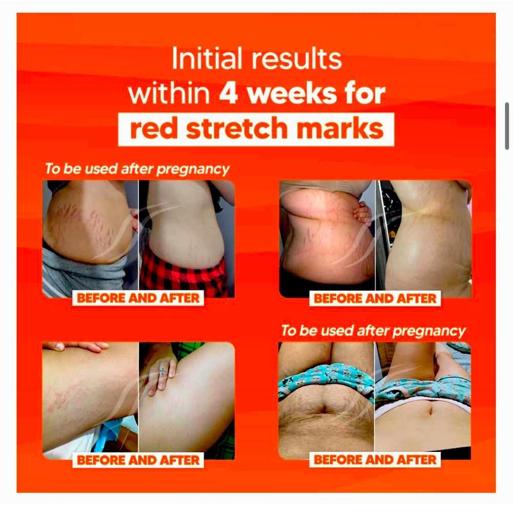 Cicatrissim - Picture 3 of 3